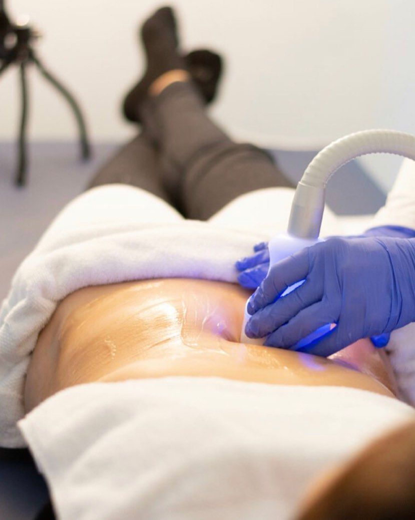 Cryo-21-behandling av mageområdet hos Ake Klinikk på Hamar